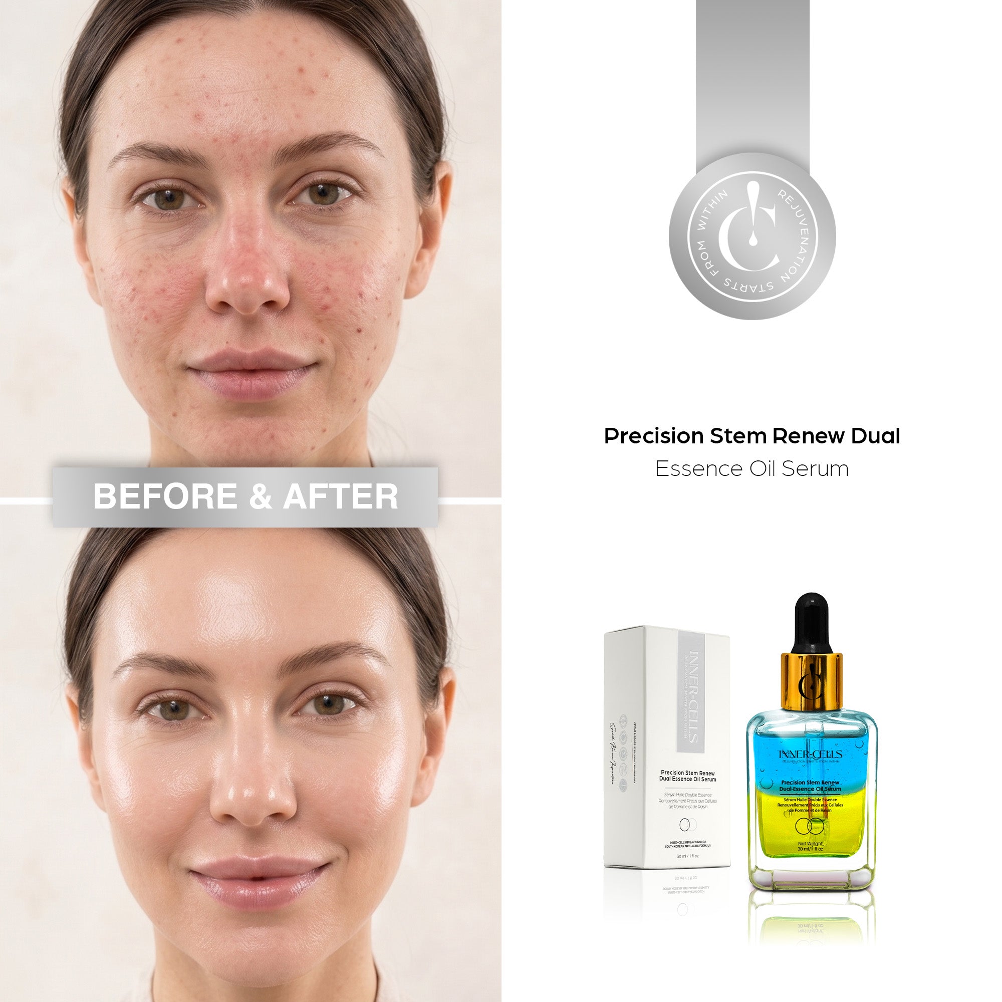 Precision Stem Renew Dual Essence Oil Serum – Inner Cells