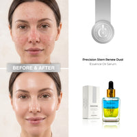 Precision Stem Renew Dual Essence Oil Serum
