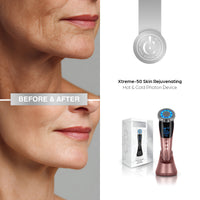 Xtreme-50 Skin Rejuvenating Hot & Cold Photon Device