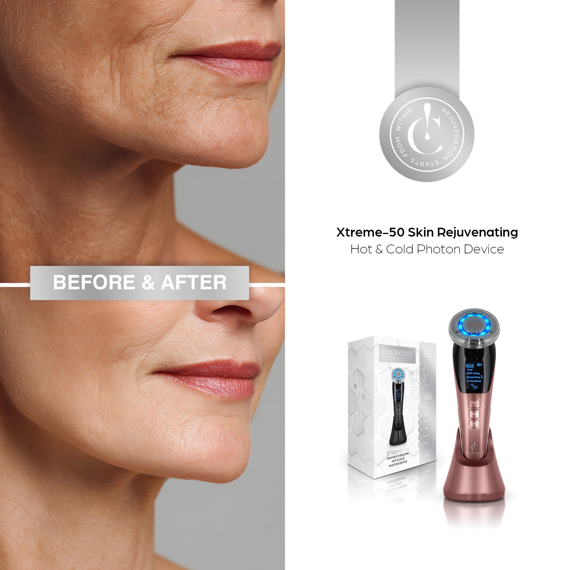 Xtreme-50 Skin Rejuvenating Hot & Cold Photon Device