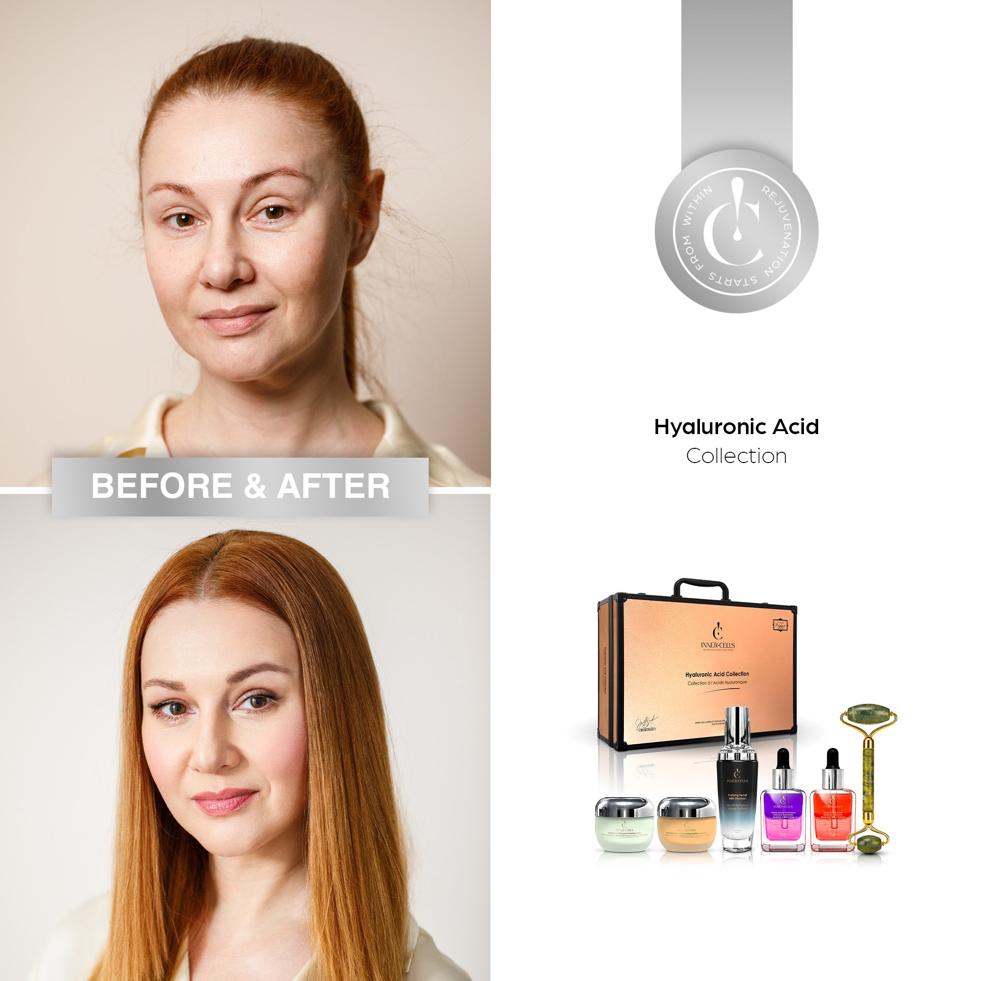 Hyaluronic Acid Collection