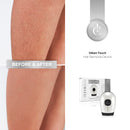 Silken Touch Hair Removal Device