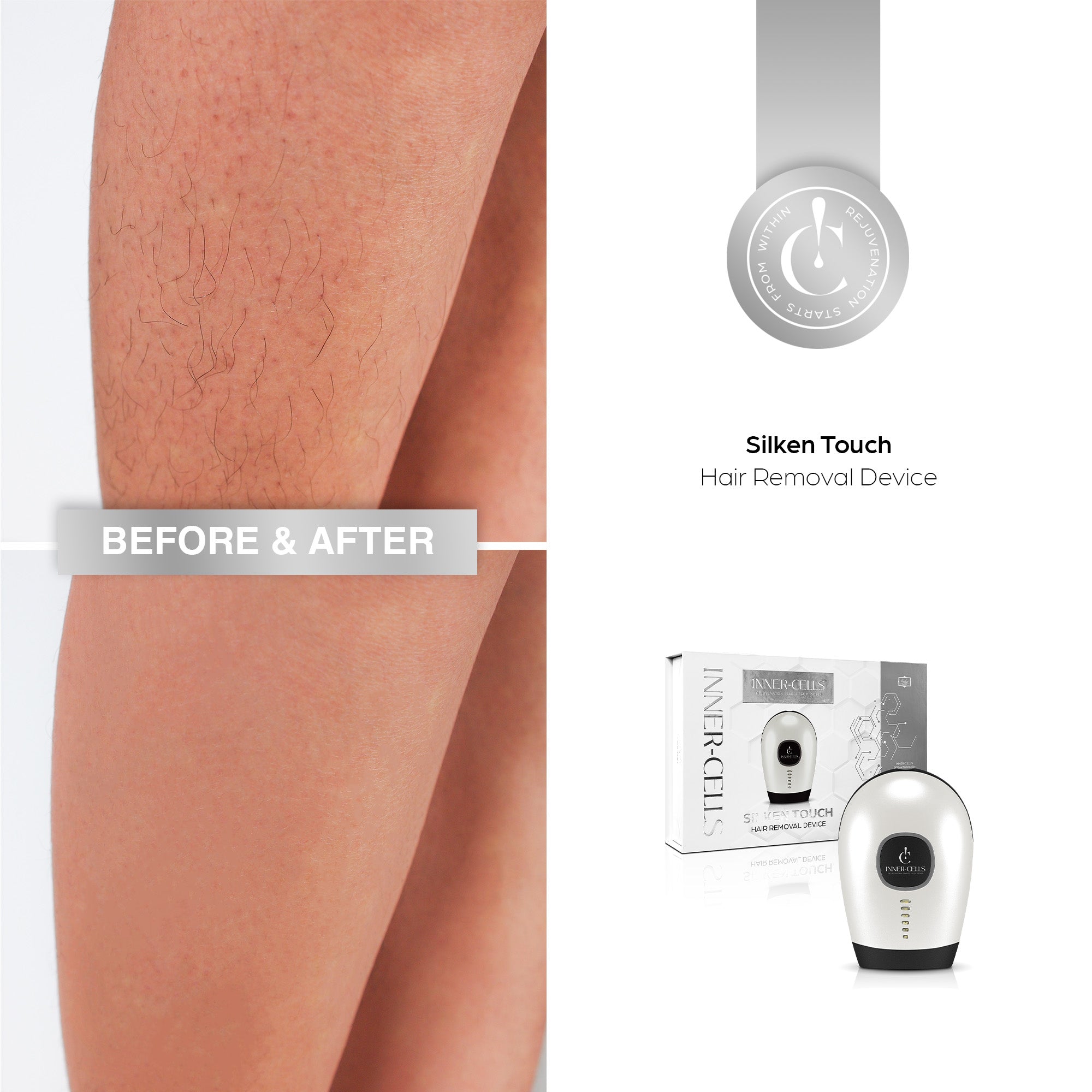 Silken Touch Hair Removal Device