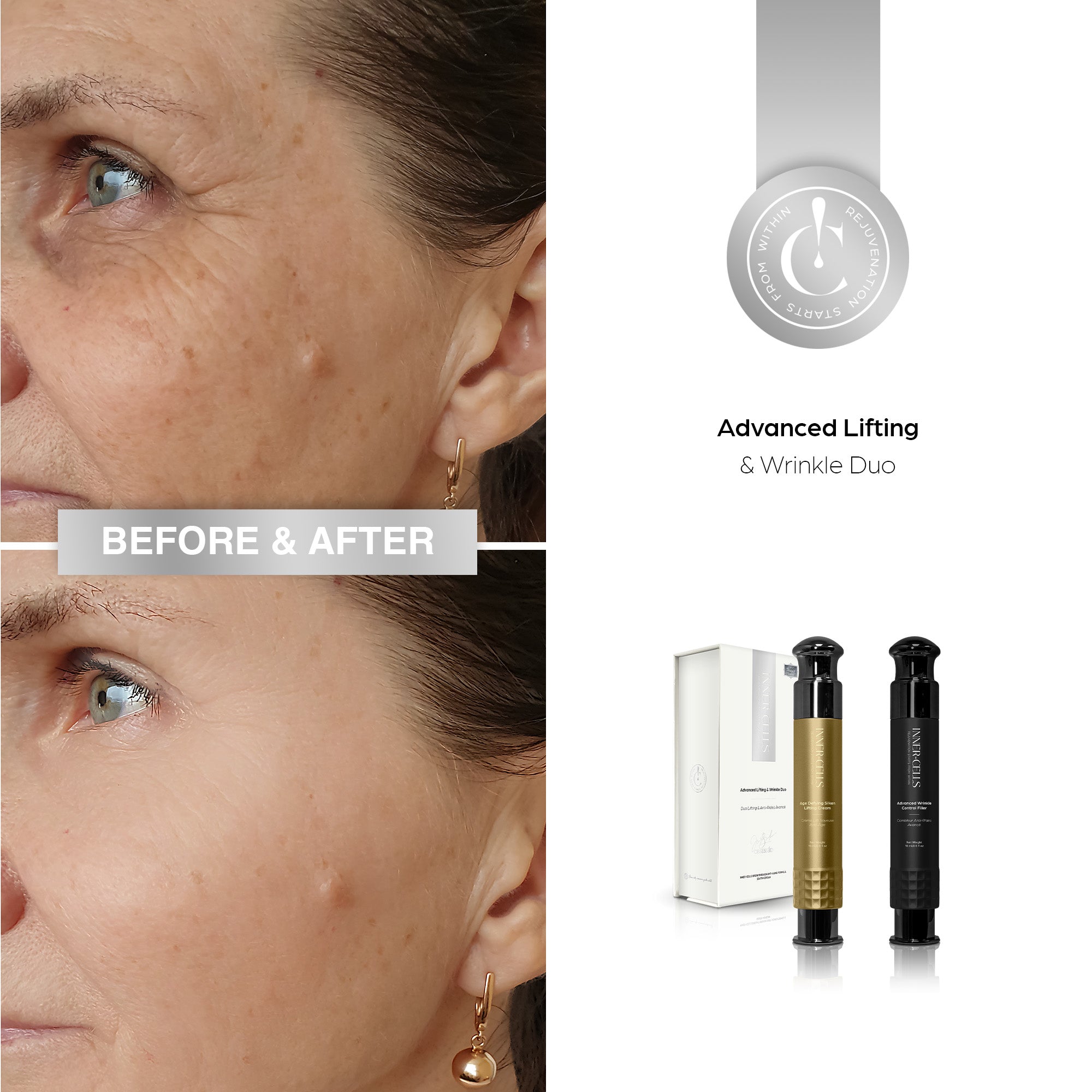 Advanced Lifting & Wrinkle Duo