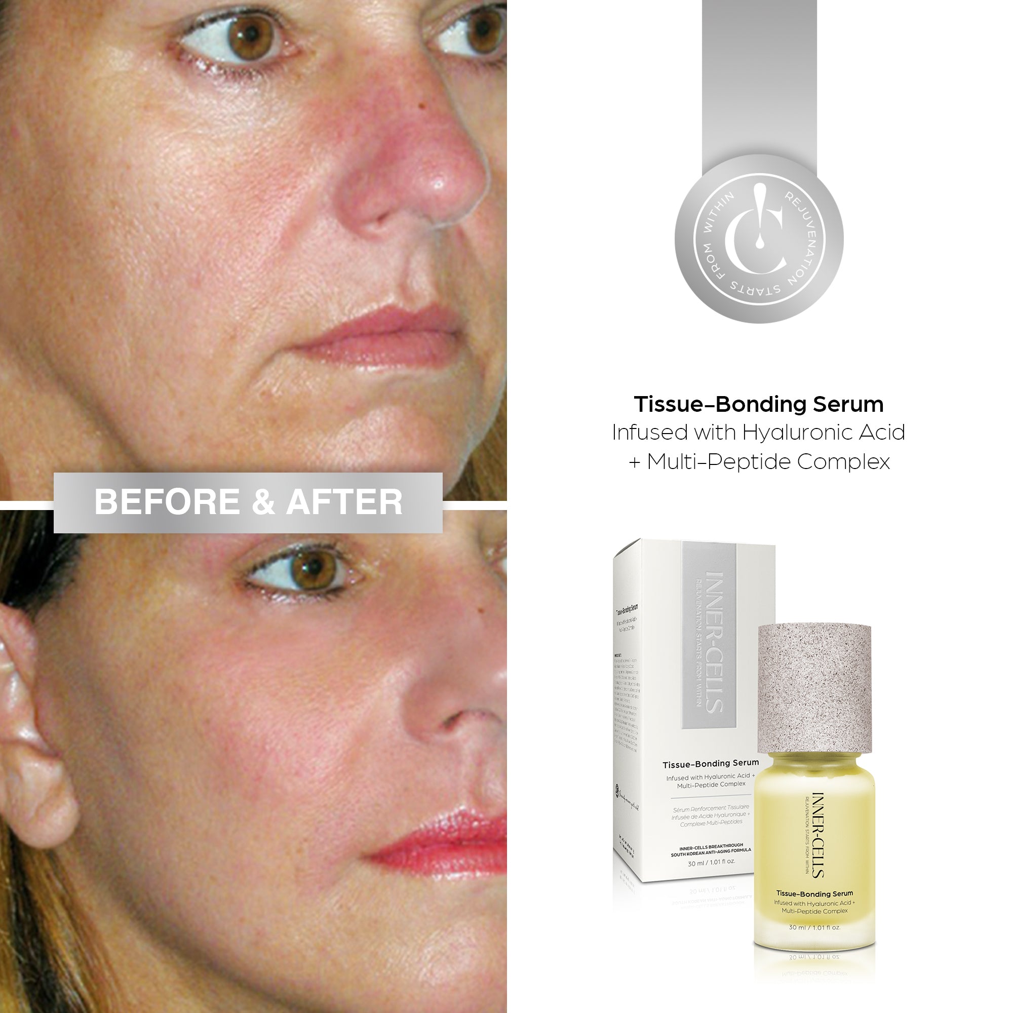 Tissue-Bonding Serum Infused with Hyaluronic Acid + Multi-Peptide Complex