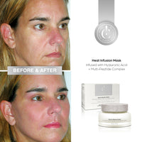 Heat Infusion Face Mask Infused with Hyaluronic Acid + Multi-Peptide Complex