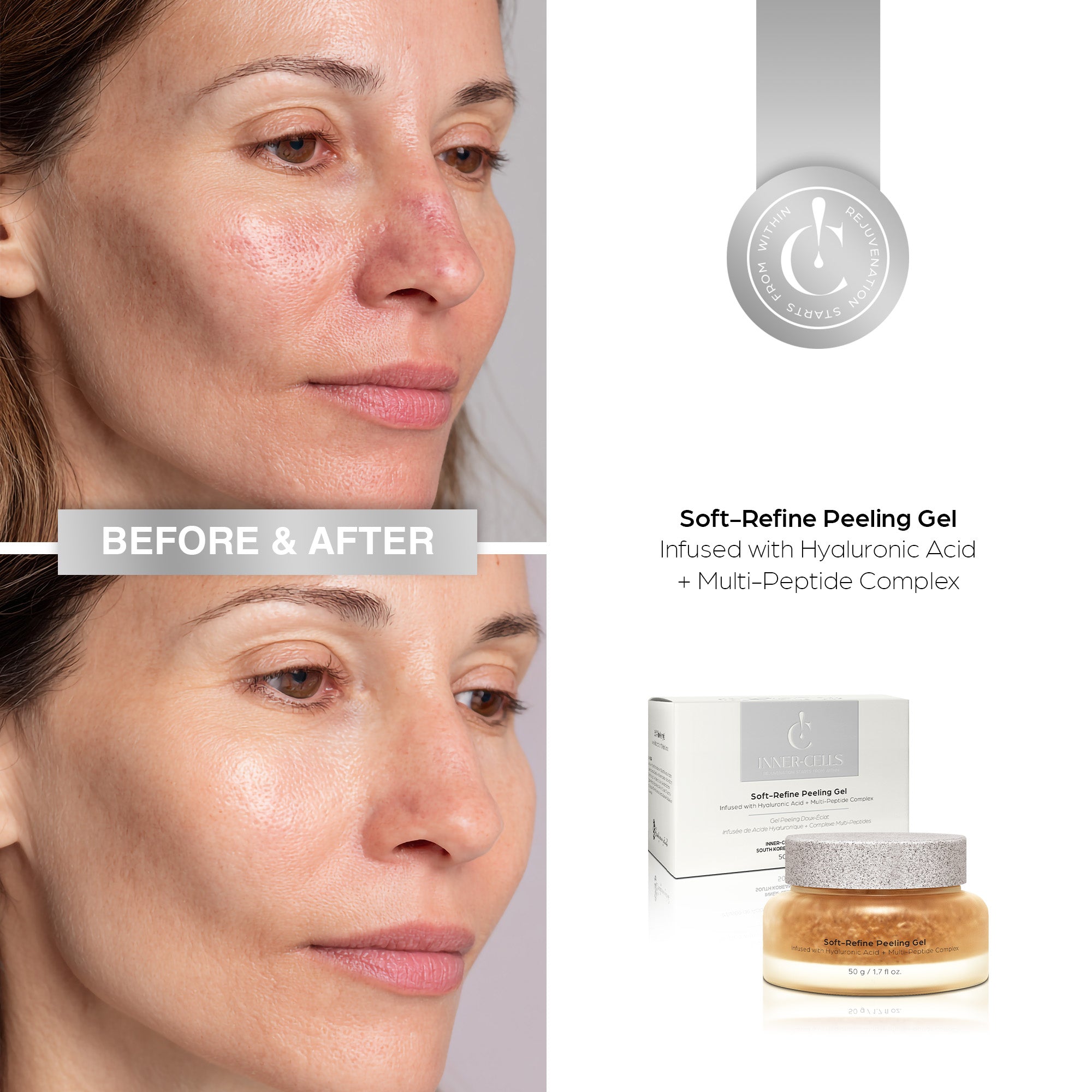 Soft-Refine Peeling Gel Infused with Hyaluronic Acid + Multi