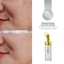 Essential Purifying Lava Foam Cleanser Infused with Hyaluronic Acid + Multi-Peptide Complex